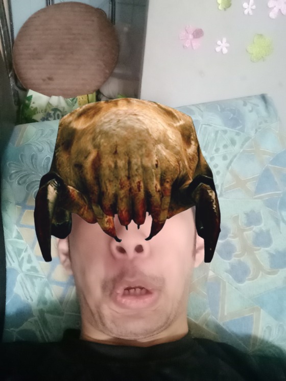 Look what happened to me.
Because headcrab is on my head.